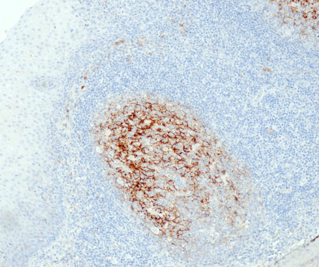 Humane Tonsille gefärbt mit Anti-C4d (QR053).