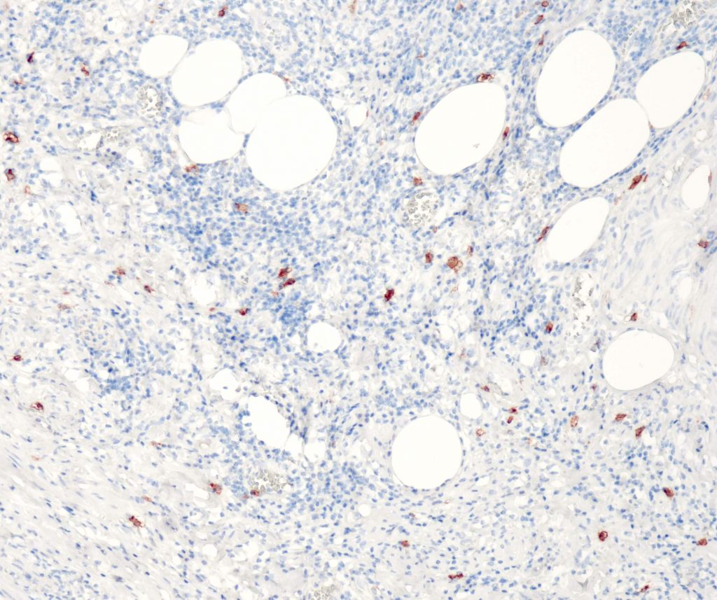 Humaner Blinddarm gefärbt mit Anti-CD117 (QR012) - deutliche, starke Färbung aller Cajal-Zellen in der Muscularis propria des Blinddarms, glatte Muskelzellen sind negativ.