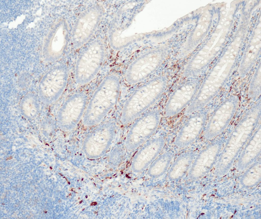 Humaner Appendix gefärbt mit Anti-CD56 (QR044) - starke und deutliche Membranfärbung der peripheren Nerven.