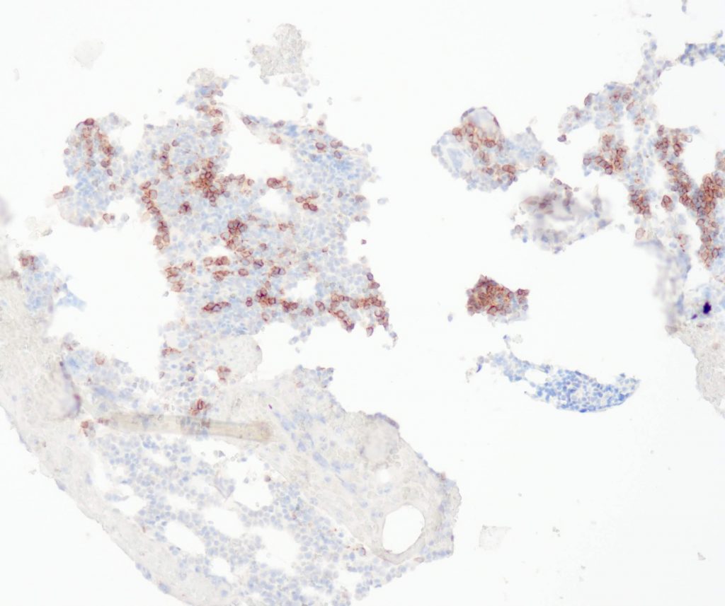 Humanes Knochenmark gefärbt mit Anti-CD71 (QR073).