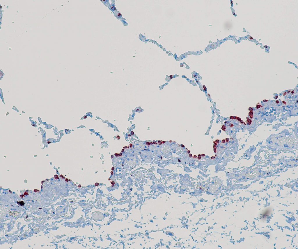 Humane Lunge gefärbt mit Anti-Napsin A (QR058).