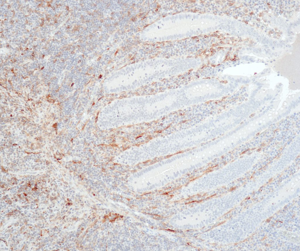 Appendix stained with anti-Podoplanin (QR048) -  strong staining of the
lymphatic endothelial cells is seen, whereas columnar
epithelial cells and goblet cells are negative.