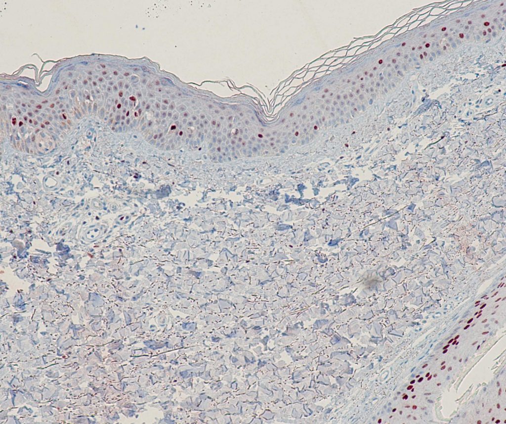 Humaner Dickdarm gefärbt mit Anti-p21 (QR085) - Kernfärbung von Epithelzellen in der Kolon-Schleimhaut.