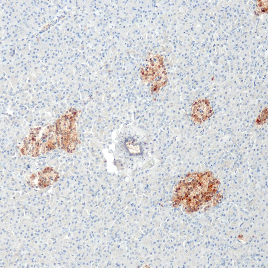 Humaner Pankreas gefärbt mit Anti-NSE (QR104).