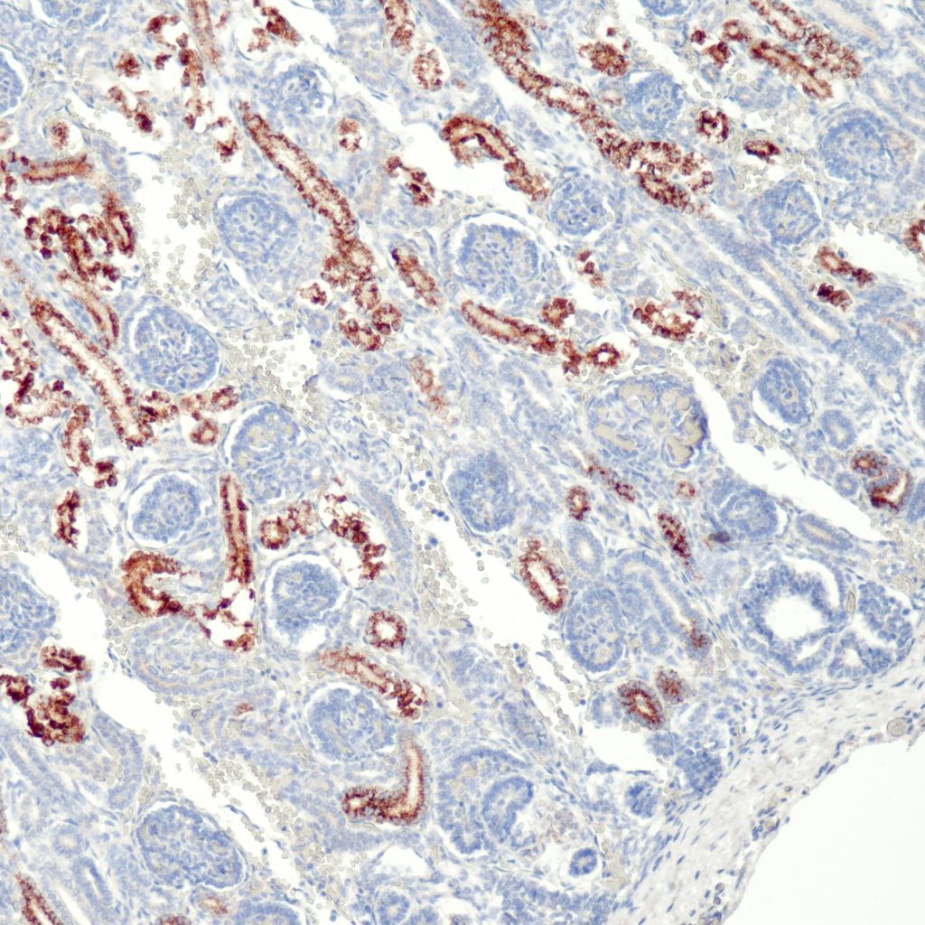 Humane 
Niere gefärbt mit Anti-AMACR (QR108) - starke granuläre zytoplasmatische Färbung der Epithelzellen der proximalen Tubuli, Epithelzellen der distalen Tubuli zeigen eine schwache granuläre zytoplasmatische Färbereaktion.