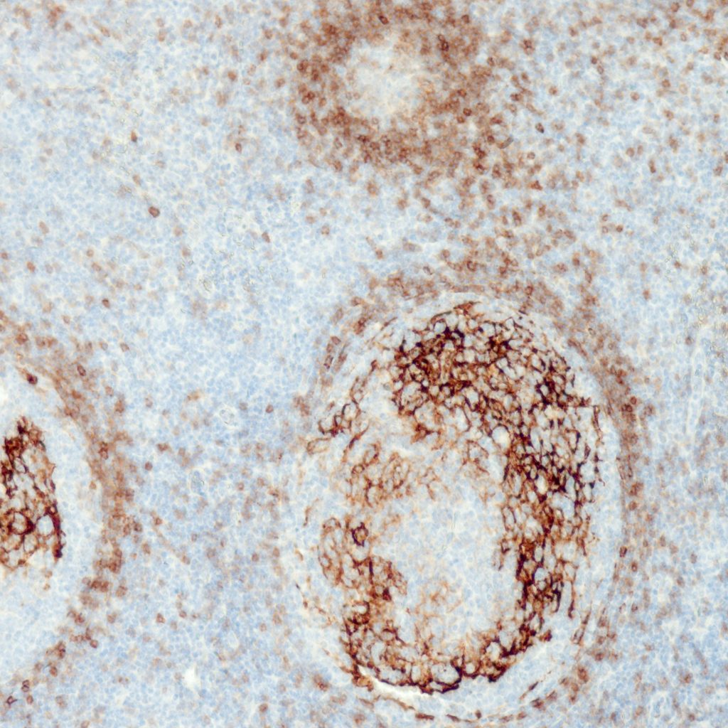 Humane Tonsille gefärbt mit Anti-CD23 (QR036) - mäßige, aber deutliche Membranfärbung der meisten B-Zellen in der Mantelzone, follikuläre dendritische Zellen der Keimzentren weisen eine starke Färbung auf.