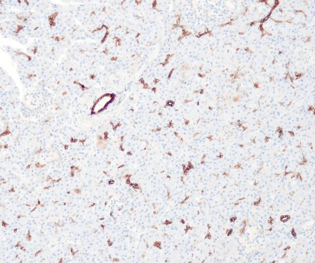 Humaner Pankreas gefärbt mit Anti-CK7 (QR049) - schwache bis mäßige zytoplasmatische Färbereaktion praktisch aller Interkalationsgänge, Epithel der großen Gänge zeigt starke zytoplasmatische Färbeintensität. Die Epithelzellen der Azinusstrukturen sind negativ.