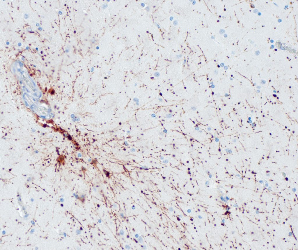 Brain stained with anti-GFAP (QR066).