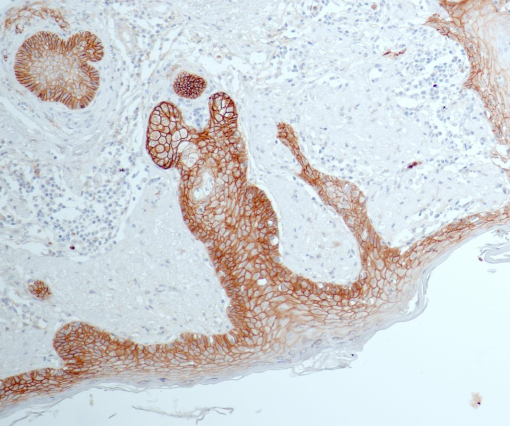 Human skin stained with anti-EGFR (QR078).