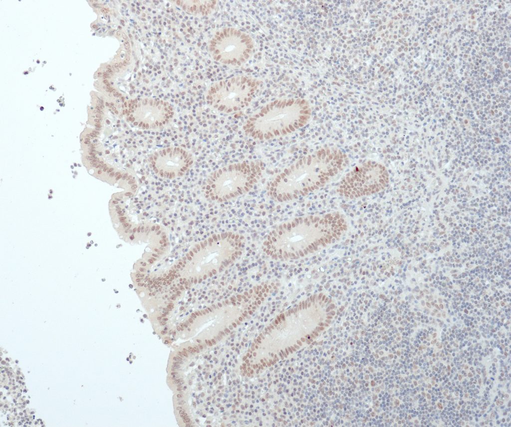 Appendix stained with Anti-BAP1