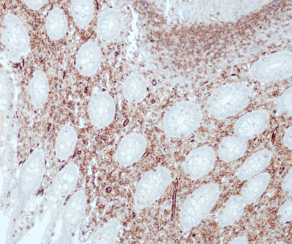 Appendix stained with Anti-CD31